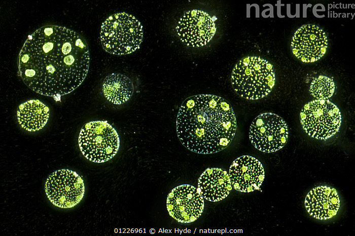 Stock photo of Electron micrograph of Protozoa {Volvox aureus} in pond ...