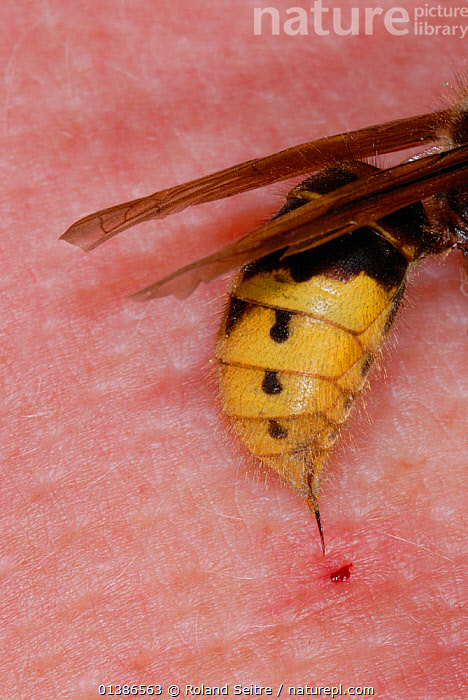 european hornet sting