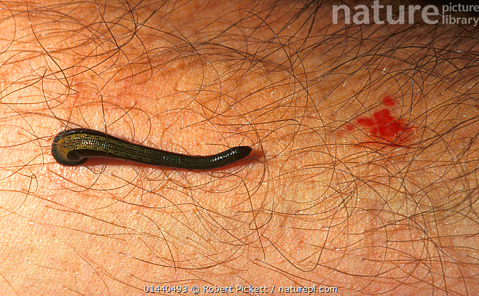 Stock photo of Tiger Leech (Haemadipsa picta) feeding on human arm, Dannum  Valley, Sabah…. Available for sale on