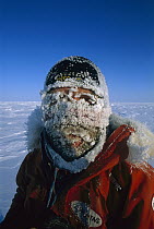 Jon Muir iced-up face on trek from Siberia to North Pole, Arctic