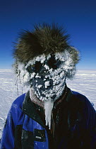 Jon Muir iced-up face on trek to South Pole, Antarctica