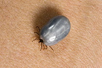 Sheep Tick (Ixodes ricinus) engorged with blood on skin, Bavaria, Germany