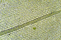 Brazilian Waterweed (Egeria densa) leaf showing chloroplasts and cell walls