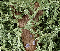 Lavender Cotton (Santolina chamaecyparissus) trichomes, magnified 759 times, Barcelona, Spain