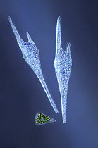 Dinoflagellate (Ceratium sp) group, magnified 400x, Barcelona, Spain
