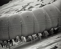SEM close-up of a millipede at 70x magnification showing 2 pair of legs per body section, the attribute distinguishing this group from centipedes which have but a single pair of legs per section