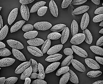 Trumpet Lily (Lilium longiflorum) SEM close-up view of pollen grains at 105x magnification