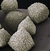 Foraminiferan (Schlumbergerella sp) SEM close-up view at 14x magnification, that came from Bali, Indonesia
