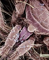 Moss Mite (Oribatidae) gnathosoma magnified 240x