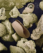 SEM close-up view of foraminiferans, molluscs and other bryozoans found on beach in Formentera, Balearic Islands, Spain