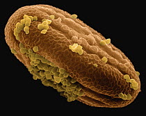 Shrimp Plant (Beloperone sp) SEM close-up view of pollen at 1620x magnifcation
