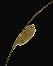 Human Louse (Pediculus humanus) SEM close-up view of egg on human hair at 35x magnification