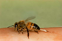 Honey Bee stinging human (Apis mellifera)