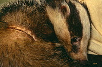 Badger with snare wound {Meles meles} England