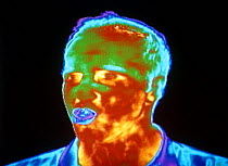 Thermograph of human head