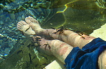 Carp feeding on legs of person suffering from Psoriasis to treat their disease, part of the BBC television series "Supernatural", Turkey, 1999