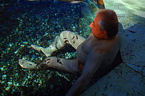 Carp feeding on legs of person suffering from Psoriasis to treat their disease, Turkey