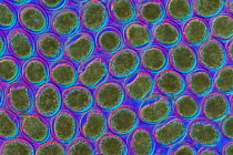 Close-up of eggs of parasitic filarial nematode worm {Toxascaris leonina} Magn. X 128