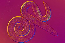 Filarial Nematode worm (Toxascaris leonina), parasite to large mammals, Magnification X 64