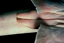 Claspers (penis) of Epaulette Shark {Hemiscyllium ocellatum} Australia, Pacific