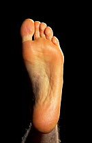 Close up of underside / sole of human foot {Homo sapiens}