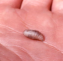 Tumbu Fly larva recently emerged from beneath the skin of a child's back. Kenya.