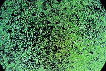 Mass of Euglena protozoa in freshwater, UK. Magnification x10 at 6x7cm