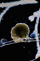 A living heliozoan protozoa {Forminifera} showing filamentous pseudopodia. Magnification: x25 at 6x7cm