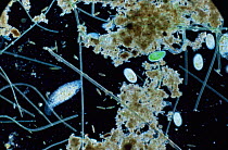 Pond life showing ciliates, diatoms and algae