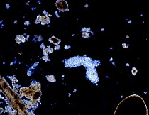 Amoeba proteus among pond debris, UK.