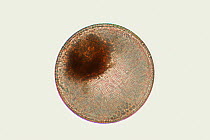 Diatom (Thalassiosira spec.) 0.1 mm, Weddell Sea, Antarctica