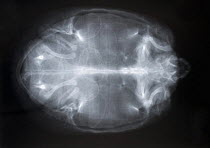 X-ray of eggs inside female Red-eared Slider turtle (Pseudemys scripta elegans) who has become egg-bound as a consequence of insufficient laying conditions