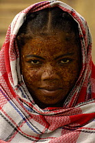 Mahafaly woman wearing sandalwood face paste to protect from the sun and as a beautification. Ampanihy, south-west coast of MADAGASCAR  . 2005