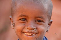 Young boy with flies around his mouth and eyes, Lalibella, North Ethiopia.  2006