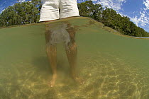 Person standing in shallow water with Box jellyfish {Chiropsalmus sp.} Queensland, Australia 2006
