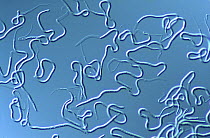 Roundworm {Brugia malayi} cause of human filariasis, Magnification x40
