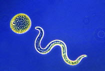 Roundworm {Toxocara canis} larva with egg, Magnification x40 using phase contrast