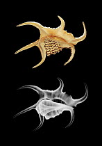 Photograph and X-ray of shell of the Spider conch  {Lambis chiragra}
