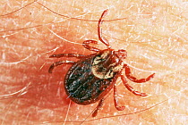 Wood tick {Dermacentor variabilis} on human skin, North Dakota, USA