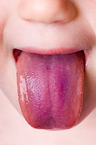 Close up of child's tongue stained purple from eating Blaeberries / Scottish Blueberries (Vaccinium myrtillus).