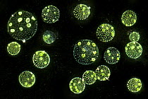 Electron micrograph of Protozoa {Volvox aureus} in pond water. Digital Composite.
