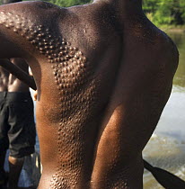 Young man with body scars from manhood initiation ceremony, said to represent the man being swallowed by a crocodile and re-born as a crocodile-man, Papua New Guinea, August 2007