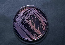 A novel actinomycetes (bacterium known to produce antibiotics) isolated from marine biomass collected from oil-rig platform growing on an agar plate, Laboratory, Louisiana State University, Baton Roug...