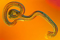 Nematode (Nippostrongylus brasiliensis) a gastrointestinal parasite of rats