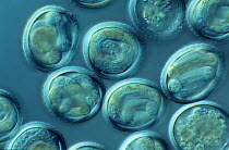 Photomicrograph of fully embryonated (Neoascaris / Toxocara vitulorum) eggs containin larvae immediately prior to hatching. Parasitic nematodes which normally infect cattle, collected from Egyptian ca...