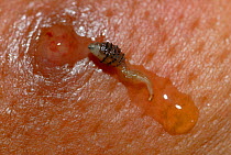 Human botfly larvae (Dermatobia hominis) recently removed from a person's skin, Amazon Rainforest, Loreto, Peru
