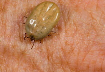 American Dog Tick / Wood tick (Dermacentor variabilis) adult on skin full of blood; Schuylkill Center, Pennsylvania, USA