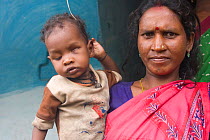 Blind boy with mother, blindness caused by the endemic effect of pollution / poor diet, industrial slum, Bhopal, Madhya Pradesh, India, November 2008