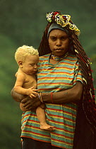 Portrait of young Yali woman carrying her albino baby. West Papua, former Irian-Jaya, Indonesia, August 2002 (West Papua).