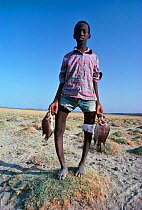 El Molo child suffering from rickets, caused by a diet consisting primarily of fish. El Molo children suffer from vitamin D deficiency, which develops into the nutritional disease causing deformities...